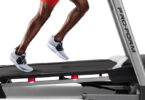 Treadmill With Knee Arthritis 6