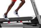 Treadmill With Knee Arthritis 1