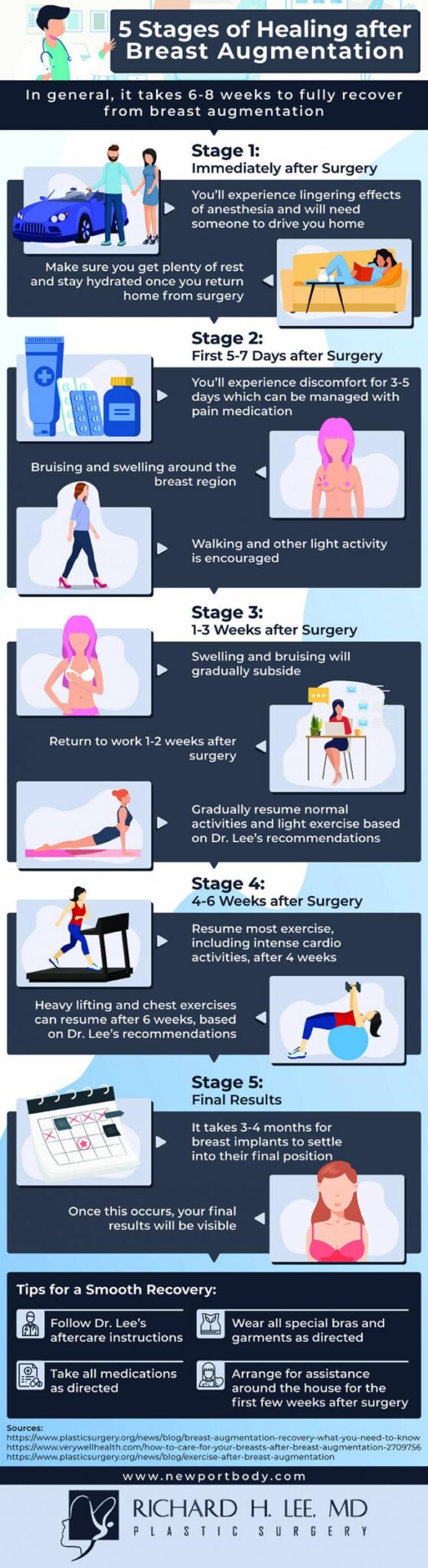 Best Arm Exercises After Breast Augmentation Grooming Wise