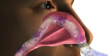Why Do I Smell Musty in My Nose
