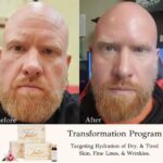 Do Collagen Supplements Work