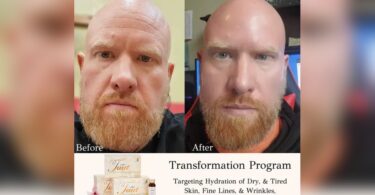 Do Collagen Supplements Work