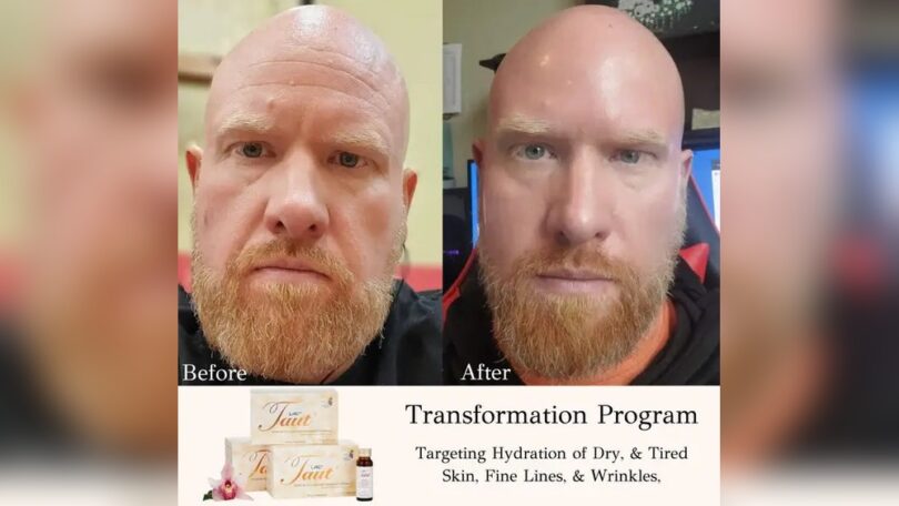 Do Collagen Supplements Work