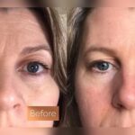 Does Collagen Supplements Work